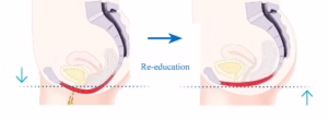 Pelvic Floor View
